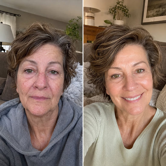 Before and after appearance