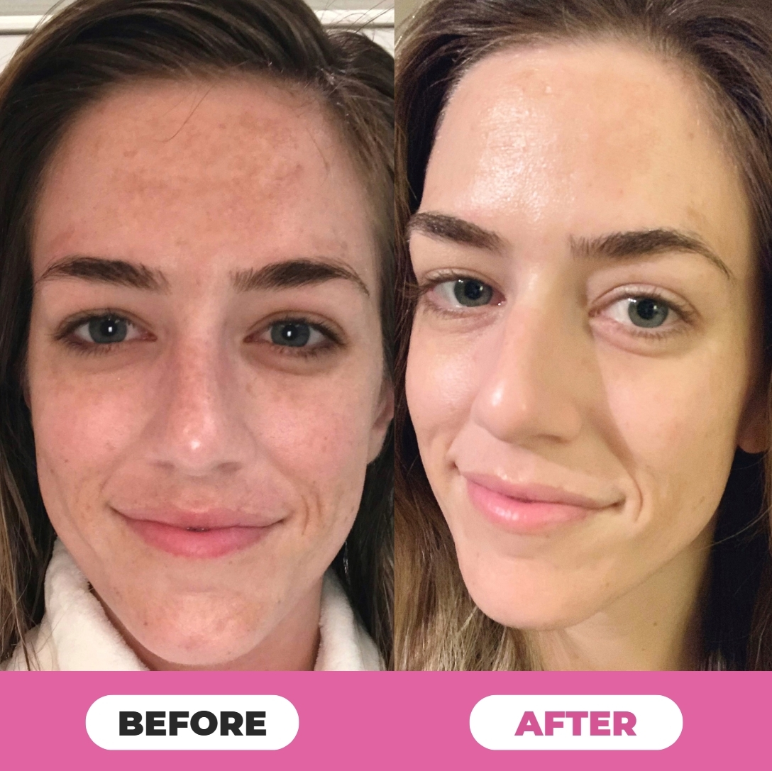 Juxek™ Multi-Corrective Calibalm — 5-in-1 Anti-Aging & Hydration Stick1