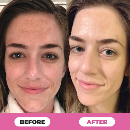 Juxek™ Multi-Corrective Calibalm — 5-in-1 Anti-Aging & Hydration Stick1