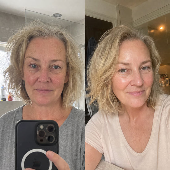 Before and after appearance