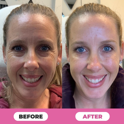 Juxek™ Multi-Corrective Calibalm — 5-in-1 Anti-Aging & Hydration Stick1