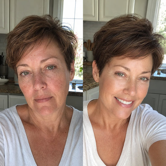 Before and after appearance