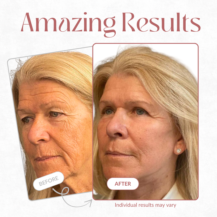 Juxek™ Multi-Corrective Calibalm — 5-in-1 Anti-Aging & Hydration Stick1